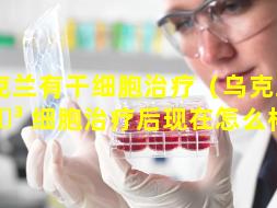 乌克兰有干细胞治疗（乌克兰干 🌳 细胞治疗后现在怎么样了）